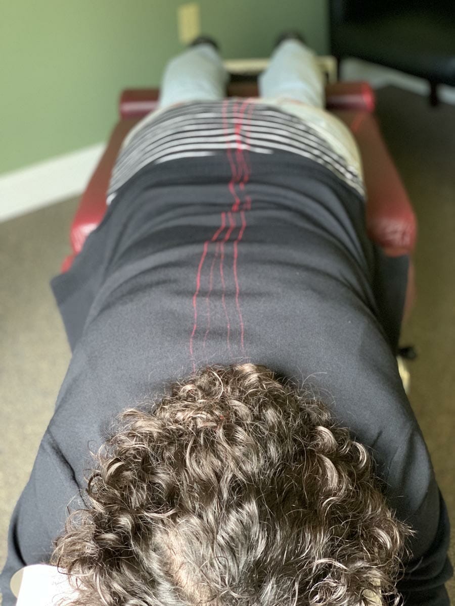 cold-laser-therapy-treatment